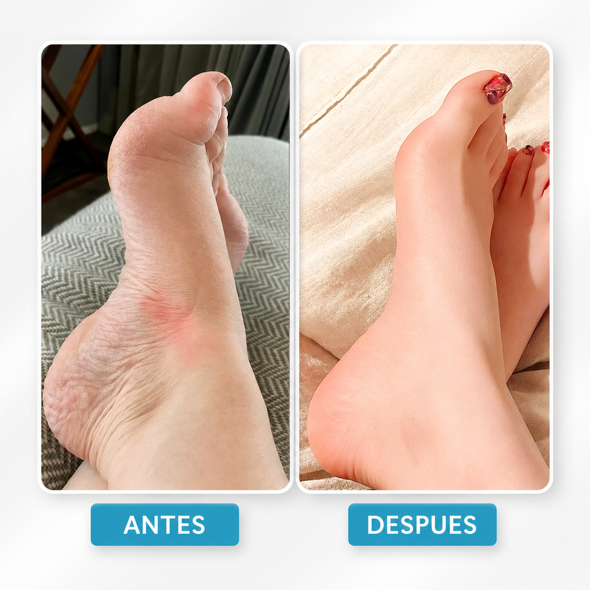 RelaxPies™ – Masajeador EMS para Circulación